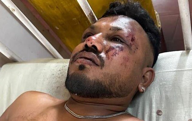 99507821-15094679-Vishwash_Kumar_Ramesh_the_British_sole_survivor_of_the_horrific_-a-49_175776414876.jpeg