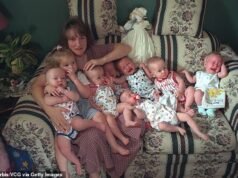 O primeiro septulatus sobrevivente do mundo celebrará seu 28º aniversário – onde estão agora