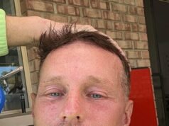 O incrível facelift de US$ 4.000 da funcionária da Humble Coles – e os resultados bizarros que ela não esperava