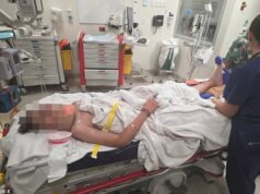 Dois meninos, de 13 anos, atacados por adolescentes mascarados enquanto andavam de bicicleta elétrica – com ferimentos graves após uma perseguição terrível