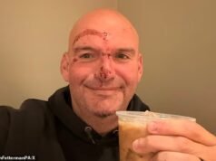 Fetterman compartilhou uma selfie sorridente com o rosto costurado após sofrer um ataque cardíaco com risco de vida