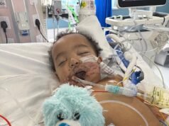 Criança tem infarto e perde metade da língua após confundir limpador de ralo com leite