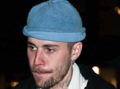 Justin Bieber machucou costelas em falha de skate elétrico