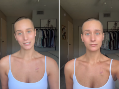 Encontrei um caroço na clavícula – O diagnóstico virou minha vida de cabeça para baixo – Newsweek